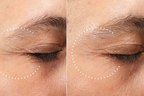 Anti-Wrinkle Eye Cream